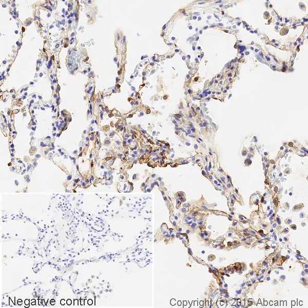 Immunohistochemistry (Formalin/PFA-fixed paraffin-embedded sections) - HRP Anti-Ezrin antibody [EP886Y] (AB198522)