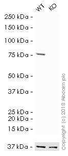 Western blot - HRP Anti-Ezrin antibody [EP886Y] (AB198522), expandable thumbnail