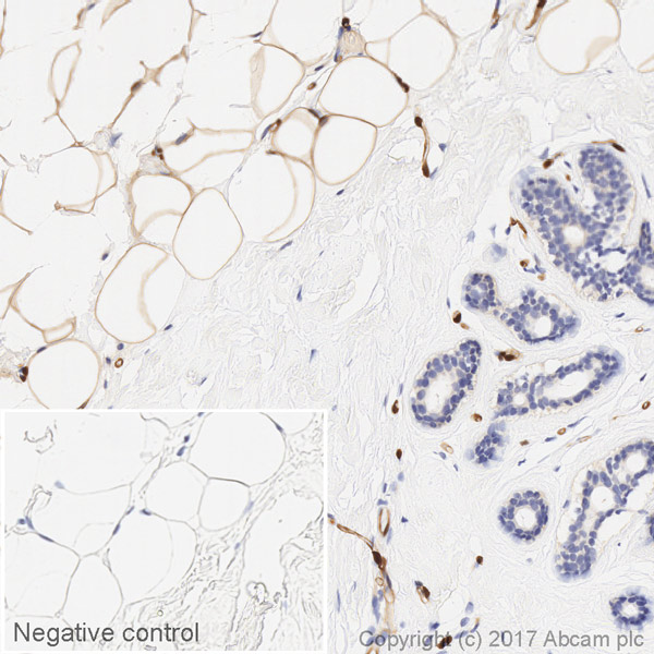Immunohistochemistry (Formalin/PFA-fixed paraffin-embedded sections) - HRP Anti-FABP4 antibody [EPR3579] (AB216528), expandable thumbnail