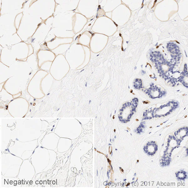 Immunohistochemistry (Formalin/PFA-fixed paraffin-embedded sections) - HRP Anti-FABP4 antibody [EPR3579] (AB216528)