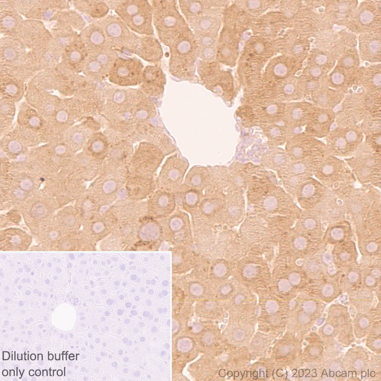 Immunohistochemistry (Formalin/PFA-fixed paraffin-embedded sections) - HRP Anti-Ferritin Heavy Chain antibody [EPR18878] (AB314244)