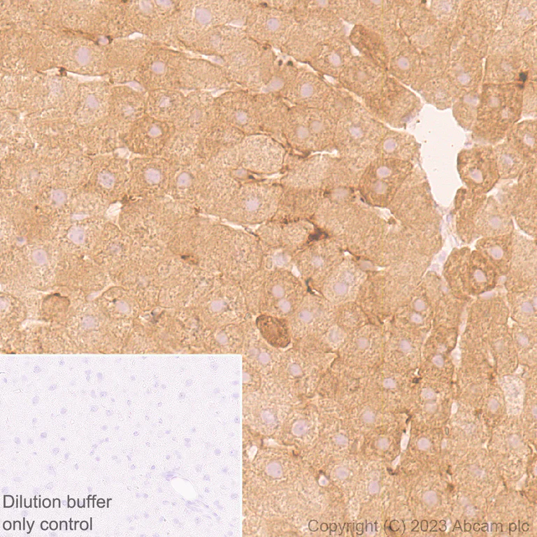 Immunohistochemistry (Formalin/PFA-fixed paraffin-embedded sections) - HRP Anti-Ferritin Heavy Chain antibody [EPR18878] (AB314244)