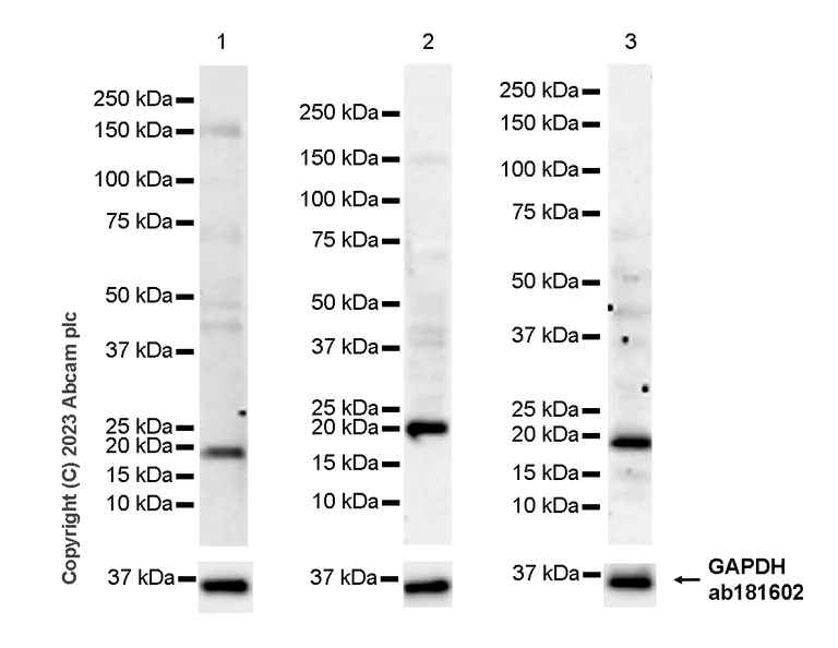 Western blot - HRP Anti-Ferritin Heavy Chain antibody [EPR18878] (AB314244)