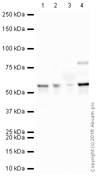 Western blot - HRP Anti-Fibrinogen beta chain antibody [EPR3083] (AB212218)