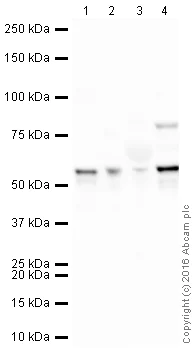 Western blot - HRP Anti-Fibrinogen beta chain antibody [EPR3083] (AB212218)