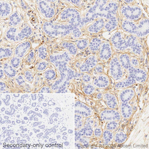 Immunohistochemistry (Formalin/PFA-fixed paraffin-embedded sections) - HRP Anti-Fibronectin antibody [EPR23110-25] (AB306318)
