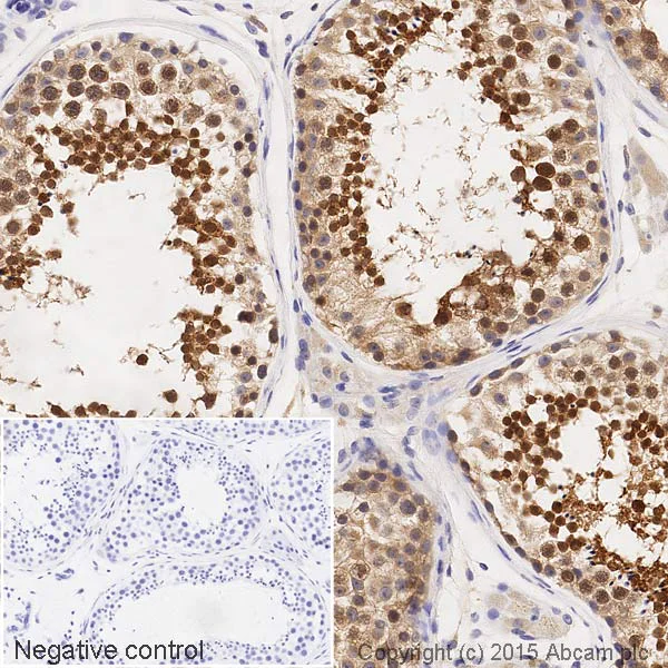 Immunohistochemistry (Formalin/PFA-fixed paraffin-embedded sections) - HRP Anti-GABARAP+GABARAPL1+GABARAPL2 antibody [EPR4805] (AB201813)