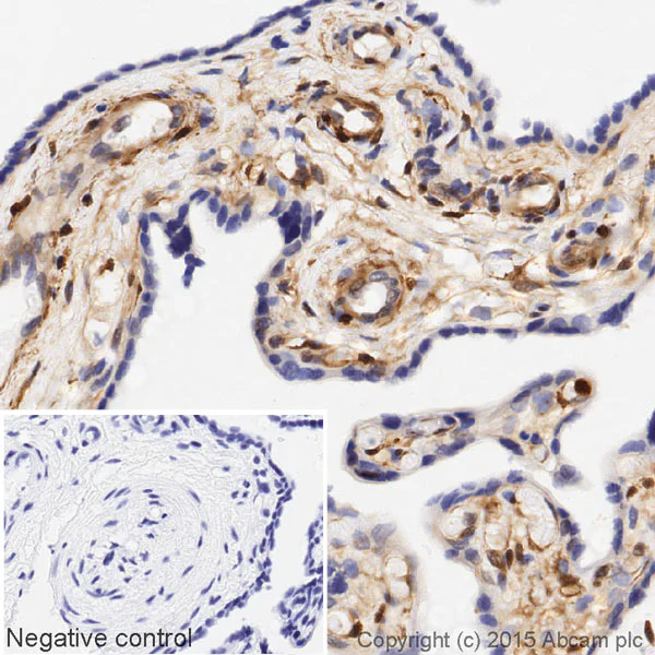 Immunohistochemistry (Formalin/PFA-fixed paraffin-embedded sections) - HRP Anti-Galectin 1 antibody [EPR3205] (AB203476)