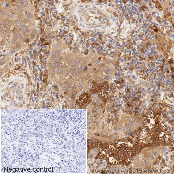 Immunohistochemistry (Formalin/PFA-fixed paraffin-embedded sections) - HRP Anti-Galectin 3 antibody [EP2775Y] (AB202553)