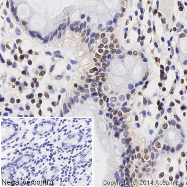 Immunohistochemistry (Formalin/PFA-fixed paraffin-embedded sections) - HRP Anti-gamma H2A.X (phospho S139) antibody [EP854(2)Y] (AB195190)