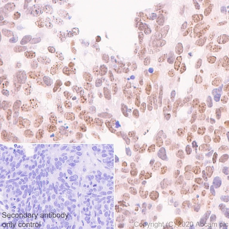 Immunohistochemistry (Formalin/PFA-fixed paraffin-embedded sections) - HRP Anti-gamma H2A.X (phospho S139) antibody [EP854(2)Y] (AB195190)