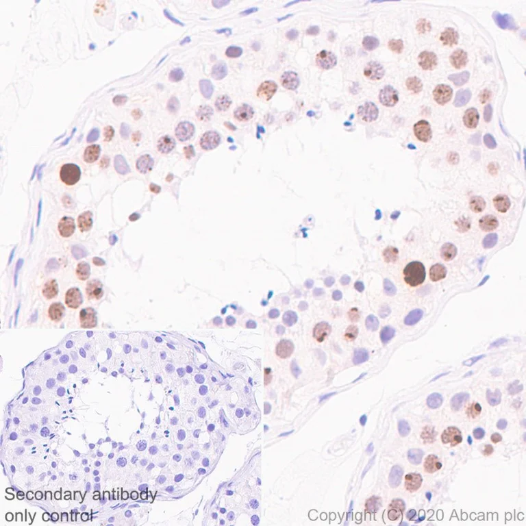 Anti-gamma H2A.X (phospho S139) HRP antibody [EP854(2)Y] (ab195190
