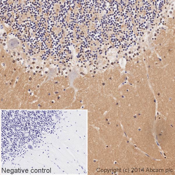 Immunohistochemistry (Formalin/PFA-fixed paraffin-embedded sections) - HRP Anti-GAP43 antibody [EP890Y] - Neuronal Marker (AB196325), expandable thumbnail