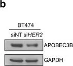 Western blot - HRP Anti-GAPDH antibody [mAbcam 9484] - Loading Control (AB9482)