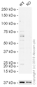 Western blot - HRP Anti-GBA antibody [EPR5142] (AB200856), expandable thumbnail