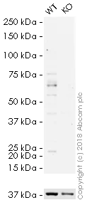 Western blot - HRP Anti-GBA antibody [EPR5142] (AB200856)
