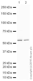 Western blot - HRP Anti-GBA antibody [EPR5142] (AB200856)