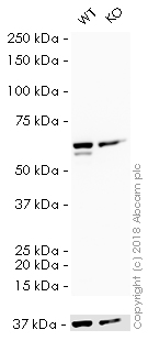 HRP Anti-Glutaminase antibody [EP7212]