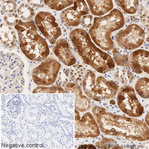 Immunohistochemistry (Formalin/PFA-fixed paraffin-embedded sections) - HRP Anti-GNAI2 antibody [EPR9469] (AB205782)
