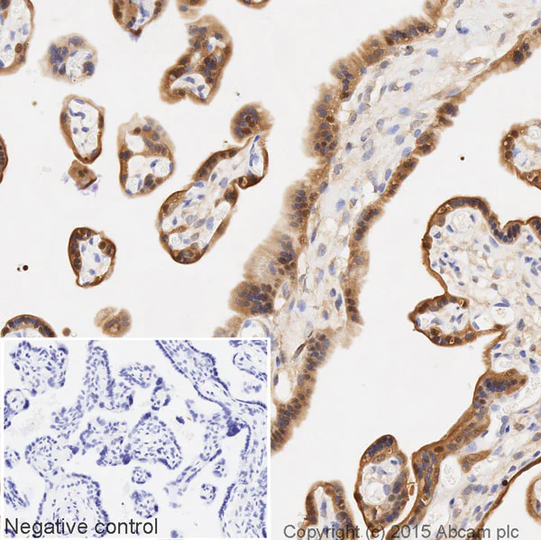 Immunohistochemistry (Formalin/PFA-fixed paraffin-embedded sections) - HRP Anti-GST3 / GST pi antibody [EPR8263] (AB202930)
