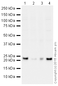 Western blot - HRP Anti-GST3 / GST pi antibody [EPR8263] (AB202930), expandable thumbnail