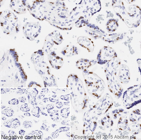 Immunohistochemistry (Formalin/PFA-fixed paraffin-embedded sections) - HRP Anti-HDGF antibody [EPR7898] (AB201820)