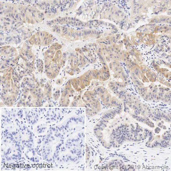Immunohistochemistry (Formalin/PFA-fixed paraffin-embedded sections) - HRP Anti-Hexokinase II antibody [EPR20839] (AB237315)