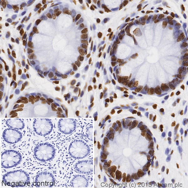 Immunohistochemistry (Formalin/PFA-fixed paraffin-embedded sections) - HRP Anti-Histone H2B antibody [mAbcam 52484] (AB204463)