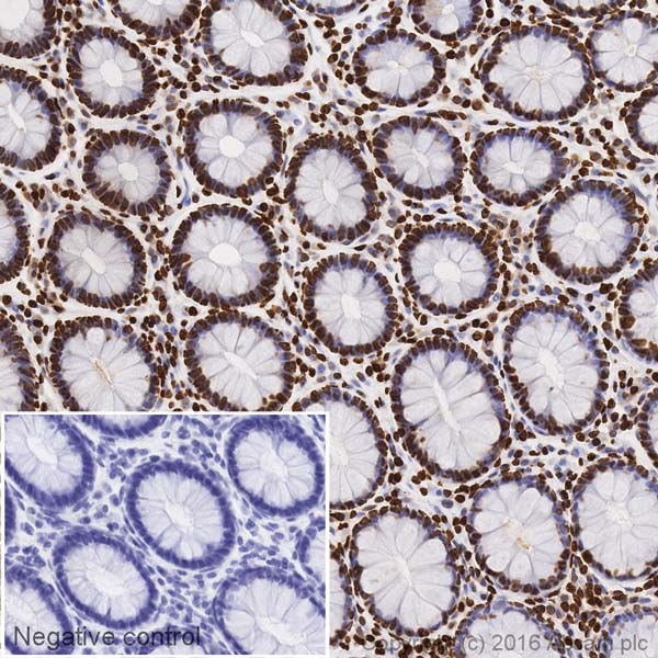 Immunohistochemistry (Formalin/PFA-fixed paraffin-embedded sections) - HRP Anti-Histone H3 antibody [EPR16987] - Nuclear Loading Control (AB209023)