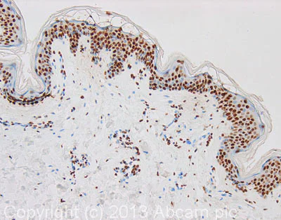 Immunohistochemistry (Formalin/PFA-fixed paraffin-embedded sections) - HRP Anti-Histone H3 antibody - Nuclear Loading Control (AB21054)