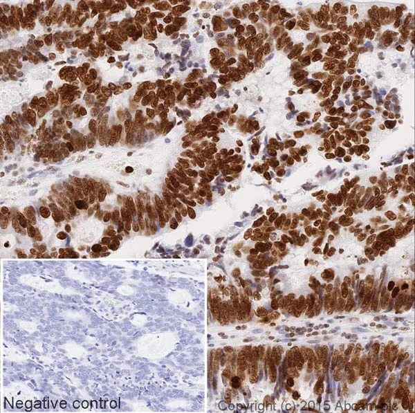 Immunohistochemistry (Formalin/PFA-fixed paraffin-embedded sections) - HRP Anti-Histone H3 (phospho S10 + T11) antibody [E173] (AB200616)