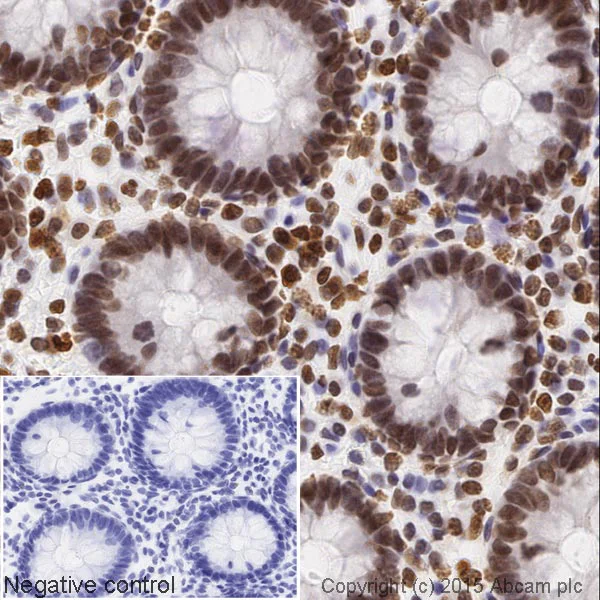 Immunohistochemistry (Formalin/PFA-fixed paraffin-embedded sections) - HRP Anti-Histone H4 (acetyl K16) antibody [EPR1004] (AB200859)