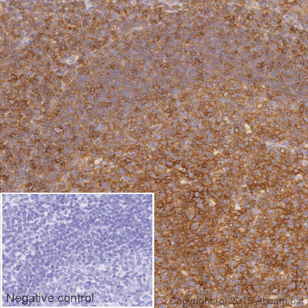 Immunohistochemistry (Formalin/PFA-fixed paraffin-embedded sections) - HRP Anti-HLA A antibody [EP1395Y] (AB199555), expandable thumbnail
