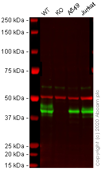 Western blot - HRP Anti-HLA A antibody [EP1395Y] (AB199555), expandable thumbnail