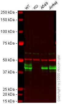 Western blot - HRP Anti-HLA A antibody [EP1395Y] (AB199555)