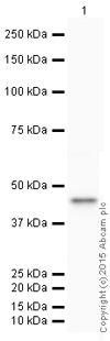 Western blot - HRP Anti-HLA A antibody [EP1395Y] (AB199555), expandable thumbnail