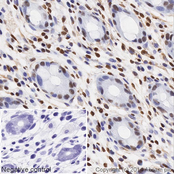 Immunohistochemistry (Formalin/PFA-fixed paraffin-embedded sections) - HRP Anti-HMGB1 antibody [EPR3507] (AB195012)
