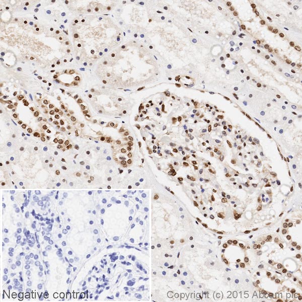 Immunohistochemistry (Formalin/PFA-fixed paraffin-embedded sections) - HRP Anti-hnRNP K antibody [F45 P9 C7] (AB204456), expandable thumbnail