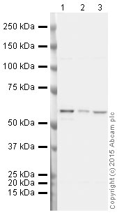 Western blot - HRP Anti-hnRNP K antibody [F45 P9 C7] (AB204456), expandable thumbnail