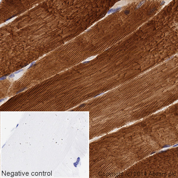 Immunohistochemistry (Formalin/PFA-fixed paraffin-embedded sections) - HRP Anti-Hsp27 antibody [EPR5477] (AB194079)