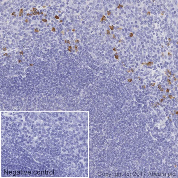 Immunohistochemistry (Formalin/PFA-fixed paraffin-embedded sections) - HRP Anti-IgG2 antibody [EPR4418] (AB209010)