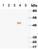 Western blot - HRP Anti-IgG3 antibody [KT94] (AB170490)