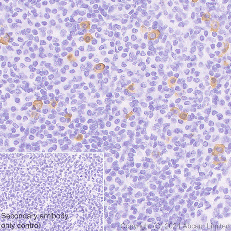Immunohistochemistry (Formalin/PFA-fixed paraffin-embedded sections) - HRP Anti-IgG4 antibody [EP4420] (AB323344)