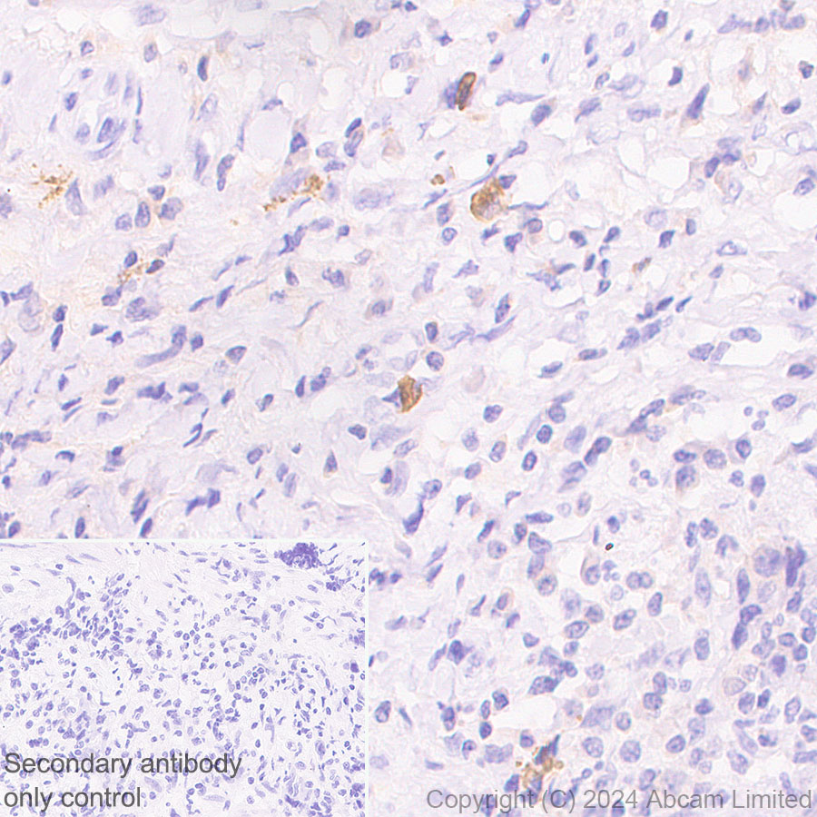 Immunohistochemistry (Formalin/PFA-fixed paraffin-embedded sections) - HRP Anti-IgG4 antibody [EP4420] (AB323344), expandable thumbnail
