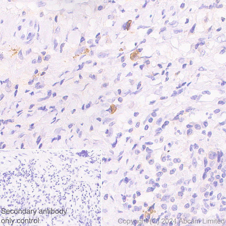 Immunohistochemistry (Formalin/PFA-fixed paraffin-embedded sections) - HRP Anti-IgG4 antibody [EP4420] (AB323344)