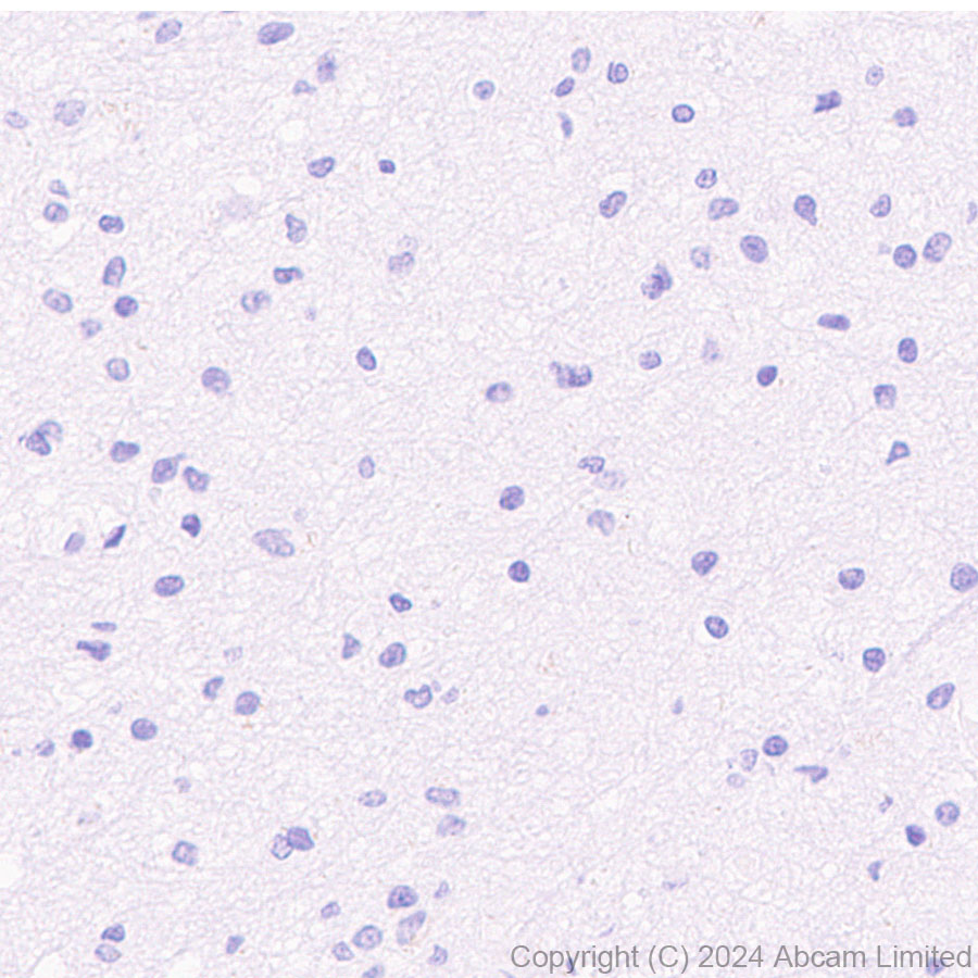 Immunohistochemistry (Formalin/PFA-fixed paraffin-embedded sections) - HRP Anti-IgG4 antibody [EP4420] (AB323344), expandable thumbnail