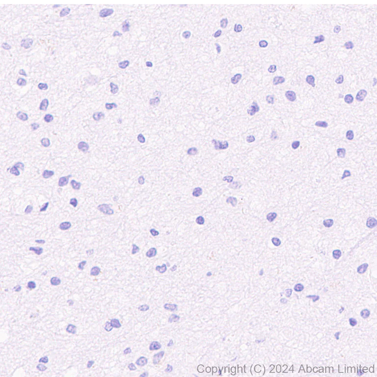 Immunohistochemistry (Formalin/PFA-fixed paraffin-embedded sections) - HRP Anti-IgG4 antibody [EP4420] (AB323344)