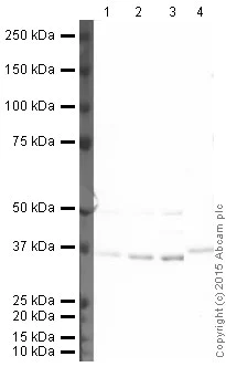 Western blot - HRP Anti-IKB alpha antibody [E130] (AB202646)