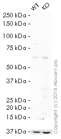 Western blot - HRP Anti-IKK beta antibody [Y466] (AB194713), expandable thumbnail