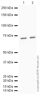 Western blot - HRP Anti-IKZF3 antibody [EPR9342(B)] (AB198961)